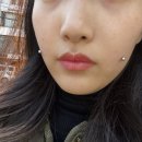 보조개 피어싱 2주차 제거 보조개 생김!