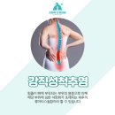 고릴라신경외과의원 네이버블로그