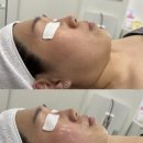버블독스 가정루원시티점 | 가정동 피부관리 데콜테 윤곽 관리 후기 루담에스테틱 루원시티점