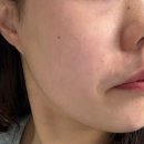 미라클약국 | 약국 화장품 추천 라멜린 미라클레티날에이크림 피부결개선 레티날크림