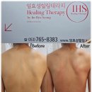 힐링브레인 체형관리 | 대구 수성구 두산동 에스테틱 임효성힐링 척추측만증 체형관리 후기