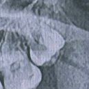 피개행개 이미지