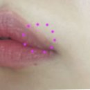 오케이메디칼 이미지