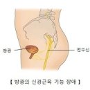 방광의 신경근육 기능 장애 (Neuromuscular dysfunction of bladder) 이미지