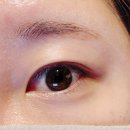강남눈썹문신제거 미오름뷰티 | 아이라인제거 잘하는 미오름뷰티 2회차 후기