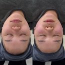 와이제이헬스케어(동구) | [대구동구 피부관리 후기] 뷰티힐링소