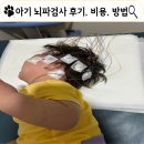 아기 뇌파검사 후기, 세균성 뇌수막염 후 뇌손상, 항경련제 줄이고 희망을 보다
