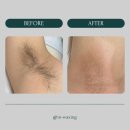 in_waxing 이미지