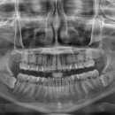 턱편한사랑니치과의원 이미지