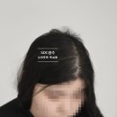 스칼프디자인센터 광주점 이미지