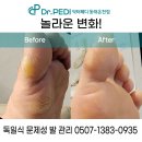 닥터페디(동래온천점) | 부산 금정구 발각질 관리 닥터페디 동래온천점에서 제대로 받아보세요