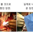 흉부외과 실습 후기