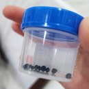 담대한외과의원 | 광주 담낭 담석 제거 찐 후기(feat.담대한외과의원)