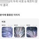 분당 두피클리닉 정자동 헤드스파 정자동 두피관리 끌로디아