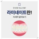 참고운미소치과교정과치과의원 | 남양주 호평동 치과 라미네이트, 치아교정과 미백효과를 동시에?