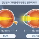 e.편한안경 네이버블로그