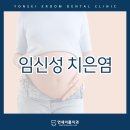 이룸치과의원 | 임신성 치은염 치료 가능한 시기는 언제일까요?