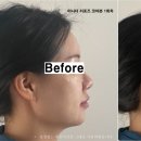 어나더근본