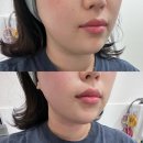 경희부부한의원 | 고양 향동 다이어트 한의원 내돈내산 덕은 경희한의원