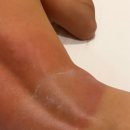 화상침구 | 세부여행 3일차 /화상 후기/모알보알-세부시티 버스이동/it파크 근처 가성비 숙소[알바우노호텔]/ it...