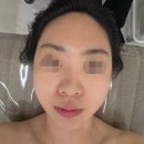 하루치즈 | 안양피부관리실 추천, 엘가비에스테틱 안양범계점 연두필 후기
