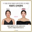 대2-28 | 웨딩 경락 후기 - 한 달이 채 안 되는 28일 만의 변화 위뷰티