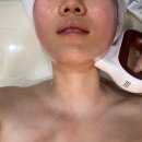 빛나는뷰티 - 청주시 서원구 탑골로 17 | [빛나는 뷰티] 안산 피부관리 수기&초음파 윤곽 관리 후기