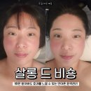 작은얼굴에스테틱 | 울산 남구 피부관리 살롱드비숑 수기 윤곽관리 작은얼굴 만드는 에스테틱 샵 후기