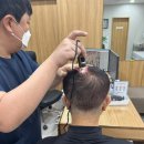 알파성형외과의원 | 청주 탈모병원 우리연합의원으로 오시는 이유