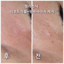 아름J뷰티 네이버블로그