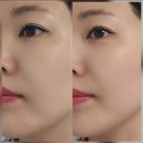 산림약국 | 수영장에서 쓰는 저자극 폼클렌징 추천｜세안 후 당김 없었던 카렌듈라 포밍 클렌저 후기