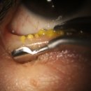 대연본안과의원 이미지