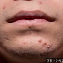 오아로피부과의원 - 노원구 노해로 507 | 강동구피부과, 강동오아로피부과의원 당신의 피부 고민 해결하기!