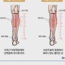 자다가 종아리 쥐 및 쥐나는 이유 알아봐요 이미지