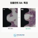 유니시티BA