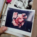 임테크 | 24주차 임신당뇨검사 독감주사 초음파 봄봄이와 만남