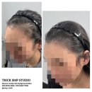 보정된 전,후 사진 / 광고업체의 후기가 고객의 판단력을 흐린다! [노원탈모커버전문] 트릭smp