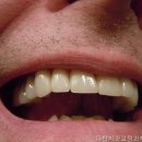 더탑치과교정과치과의원 네이버블로그