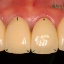 선 치과기공소 이미지