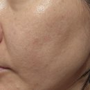 주식회사 앰플 | 내돈내산 잡티&amp;주근깨 기미앰플 다이소 기능성 제품 후기