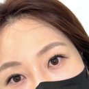 린온