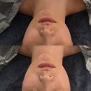 캐롤뷰티 | 신논현역 에스테틱 ‘캐롤뷰티’ 웨딩관리 받고 온 후기 (탄력·라인 개선)