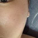 수앤뷰티피부관리 네이버블로그