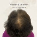 티나스칼프