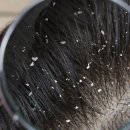 새치 | 율고 새치 염색샴푸 내돈내산 후기