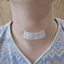 통영신세계로병원 | 부산이샘병원/갑상선결절/ 세침검사/수술전검사/입원/마취동의서/퇴원/수술후일주일외래/조직검사결과...