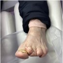 바미네일레푸스용인 | 충주시발톱무좀, 충주발관리 완전 정복! 바미네일 레푸스 충주연수점 방문 후기