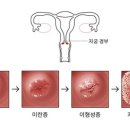 미란 이미지