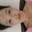 아쿠아플러스 남대구점 | 대구남구피부관리 라플러스에스떼 아쿠아필 후기
