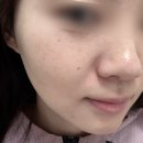 창이대로 | [창원 대방동] 중요한 날 필수 피부관리 크라이오 더마플래닝 | 올리온뷰티 솔직 후기